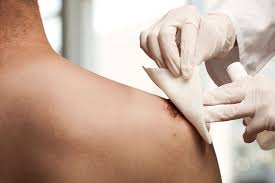 Kami senang jika bisa melayani anda :) #alkes #alatkesehatansurabaya #alkesmurah #kursiroda #velbed #tandu #bedpasien #urinbag #peralatanrumahsakit #perlengkapandokter #cervical #lumbar #setrawatluka #rawatluka #renz #gantiperban #verban jual set rawat luka / set ganti perban. Seberapa Sering Mengganti Perban Luka Jahitan Agar Tidak Infeksi