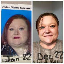 Gastric Bypass Surgery Long-Term Weight Loss Success Story