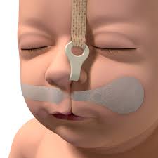New Research Confirms Effectiveness of DynaCleft System in Treatment of  Unilateral Cleft Lip & Palate (Article Review)