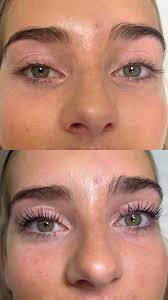 Aura Skincare Centre