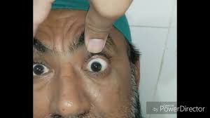 It arose at the pterygopalatine segment of the maxillary artery, either singly or from a common trunk with the artery of the foramen rotundum, and ran upward to reach the superior orbital fissure. Superior Orbital Fissure Syndrome Youtube