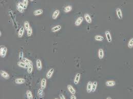 Image result for kabatina thujae