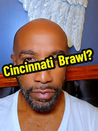 What Happened to Ncinci Yesterday