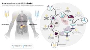 Trebek, 78, said his cancer is very advanced — stage 4. New Immunotherapy Target Identified In Treating Pancreatic Cancer Thailand Medical News