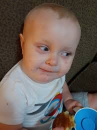 Why are Martin's EYES red? I NOTICED them in two scenes so far, in TODAY'S  episode.