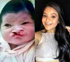 Há 15 anos em tratamento no hospital da USP, Sofia quer ser odontopediatra 