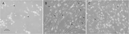 Learn about schwann cells with free interactive flashcards. Novel Method For Culturing Schwann Cells From Adult Mouse Sciatic Nerve In Vitro