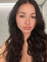 Anna Paul has revealed why shes lost weight and had bruises | NT News