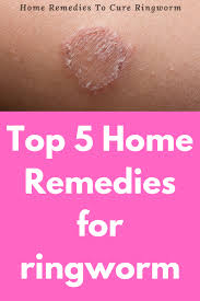 Does hand sanitizer kill viruses? 18 Home Remedies For Ringworm Skin Ideas Home Remedies For Ringworm Ringworm Ringworm Remedies