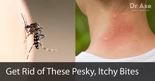 So, it is good to prevent mosquito bites as they might lead to some health complications if not acted upon promptly. Top 5 Home Remedies For Mosquito Bites Dr Axe