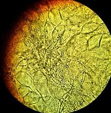 Vaginal Wet Mount Wikipedia