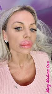 TW Pornstars - Marymadisonworld. Twitter. 👄 New lip filler today! I am  really happy the result is. 6:29 PM - 6 Apr 2021