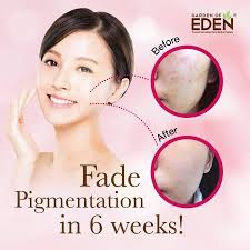 Opening from light green buds and developing into creamy white then a delicate light pink. Testimoni Serum Eden Rosa E