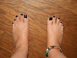 2nd 3rd Toes Separate Toes Health Separation
