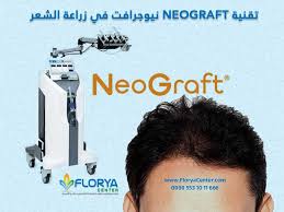 زراعة الشعر بـ تقنية Neograft نيوجرافت إن تقنية Neograft نيوجرافت في عمليات زراعة الشعر تعتبر من أبرز التقنيات بهذا المجال تعتبر هذه التقنية تطورا كبير بمجا