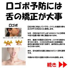 口ゴボを予防する矯正ストレッチのやり方 ゴボ 治す 歯科矯正