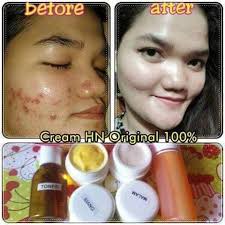 We did not find results for: Korban Cream Hn Original Anda Anugrah Kosmetik Facebook