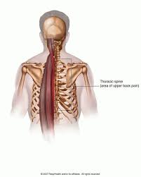 Pin On Ankylosing Spondylitis