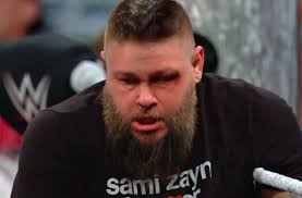 La cara de KO lo dice todo Esa derrota ante Cody lo ha dejado totalmente  enloquecidø