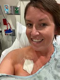 My port removal went well.