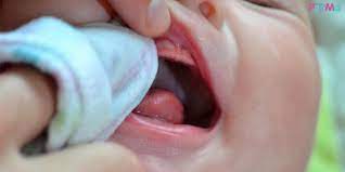 Untuk bayi yang berusia 6 bulan ke atas, sebaiknya beri minum air masak sedikit selepas menyusu. Gigi Bayi Akan Tumbuh Lengkap Selepas Usia 3 Tahun Penjagaan Gusi Mulut Sangat Penting Sejak Bayi Umur 1 Hari Pa Ma