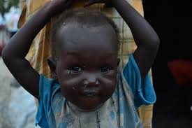 To South Sudan's woes, add famine — 50,000 kids at risk of death