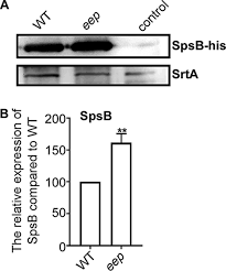 Roles of the Site 2 Protease Eep in Staphylococcus aureus | Journal of  Bacteriology