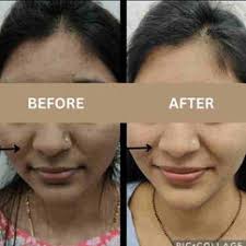 The Skin Doctors: Best Dermatologist in Pimple Saudagar, Pune