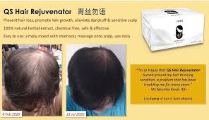 ﻿ ﻿﻿ but while some chemotherapy medications almost always result in such hair loss, others typically cause minimal hair loss. Hair Secrets Organic Hair Clinic Posts Facebook