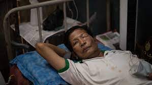 May 31, 2021 · los casos de hongo negro en la india aumentan a casi 9.000 mientras el gobierno intenta cubrir la falta de medicamentos. Que Es El Peligroso Hongo Negro Que Asocian Al Covid Y Por Que Alarma Al Mundo En Plena Pandemia