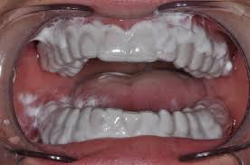 We did not find results for: Mi Paste Plus And White Spot Lesions Spear Education