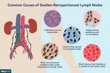 Image result for icd 9 code for retroperitoneal adenopathy