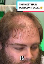 Dramatic Men's Hair Transformation: Bold Bald Look