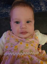 Is this a reaction to strawberries or peanut butter in infant food?