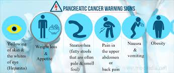 Both back pain and abdominal pain are also popular symptoms in those diagnosed with pancreatic cancer. Pancreatic Cancer All The Disease Its Diagnosis And Management