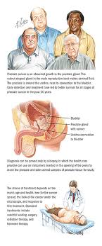 Being armed with information is vital to begin the fight. Prostate Cancer Spectrum Health