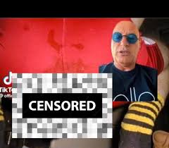 Howie mandel anal prolapse - stvincent.nupark.com