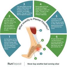 Benefits of wrapping foot for plantar fasciitis with ace bandage; 50 Shades Of Plantar Fasciitis Ultimate Guide Runrepeat