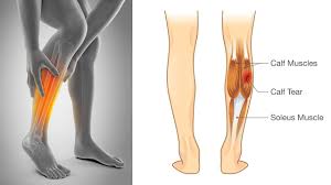 The small, lateral calf bone extending from the knee to the ankle. What Is The Anatomical Term For Your Calf Muscle Of The Lower Leg How To Train Your Calf Muscles Youtube Rifat Sahrul