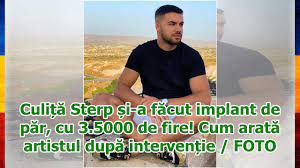 Culita sterp pacoste sau alinare? CuliÈ›Äƒ Sterp È™i A FÄƒcut Implant De PÄƒr Cu 3 5000 De Fire Cum AratÄƒ Artistul DupÄƒ IntervenÈ›ie Youtube
