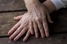 Te mai poate interesa si: Vitiligo Reginamaria Ro
