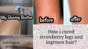 An ingrown hair occurs when hair curls around and grows back into the skin. How To Get Rid Of Strawberry Legs Ingrown Hair My Shaving Routine Ft Body Scrub Youtube
