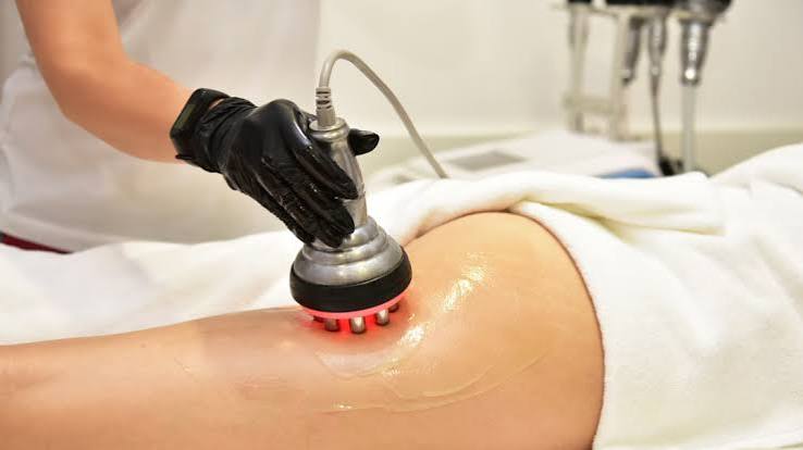 Precision Contouring Process