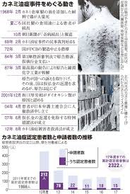 Definition of カネミ油症, meaning of カネミ油症 in japanese: ä»Šã•ã‚‰èžã'ãªã„ ã‚«ãƒãƒŸæ²¹ç—‡ ã„ã¾ã‚‚ä¸ååˆ†ãªè¢«å®³è€…æ•'æ¸ˆ æœæ—¥æ–°èžãƒ‡ã‚¸ã‚¿ãƒ«