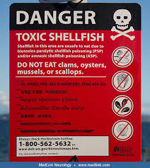Image result for Amnesic Shellfish Poisoning