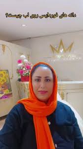 از دانه های فوردایس روی لبت ناراضی هستی؟شیدینگ جذاب مون رو بهت توصیه میکنم  ☺️💗 , هنر دستانم روی صورت شما جاودانه میشود ☺️🫶,  💫💫💫💫💫💫💫💫💫💫💫💫💫💫💫💫💫💫💫, @fereshteh.hamidi.pmu ,  💫💫💫💫💫💫💫💫💫💫💫💫💫💫💫💫💫💫💫💫, ...