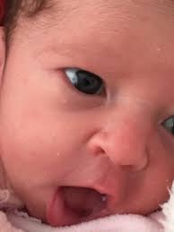 Cor De Olhos Bebe Assuntos Gerais Babycenter