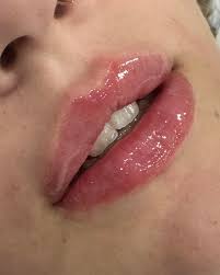 EDIT: ONLY 2 NUMBERS LEFT!!!! Numbers 12 and 17!!Let's get them picked so  we can draw it ASAP 🙏🏻 A few numbers left for the chance to win a filler  treatment!All proceeds