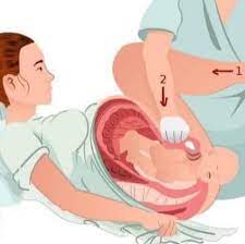 Tidak semua perineum yang robek saat melahirkan perlu dijahit. Ma Mariam 3 Tips Mudah Bersalin Normal Tanpa Jahitan Facebook