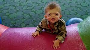 Mom Defends Son Against Offensive Internet Meme Abc News